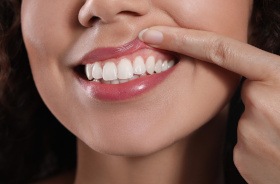 Woman lifting her lips to show her healthy gums