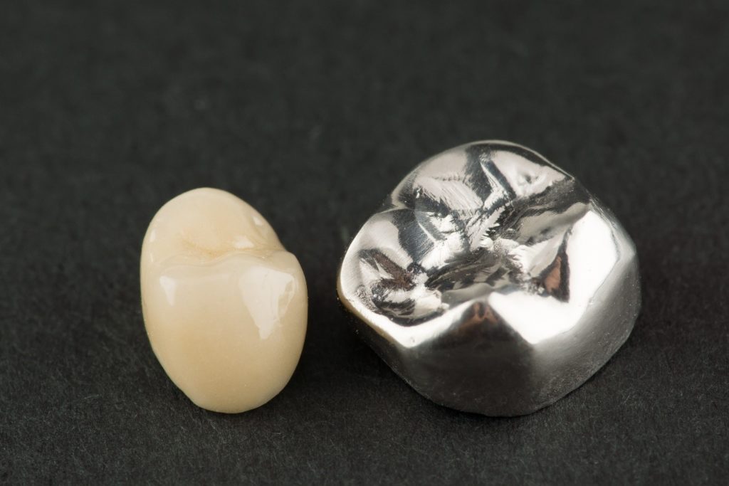 What Is the Best Dental Crown Material?